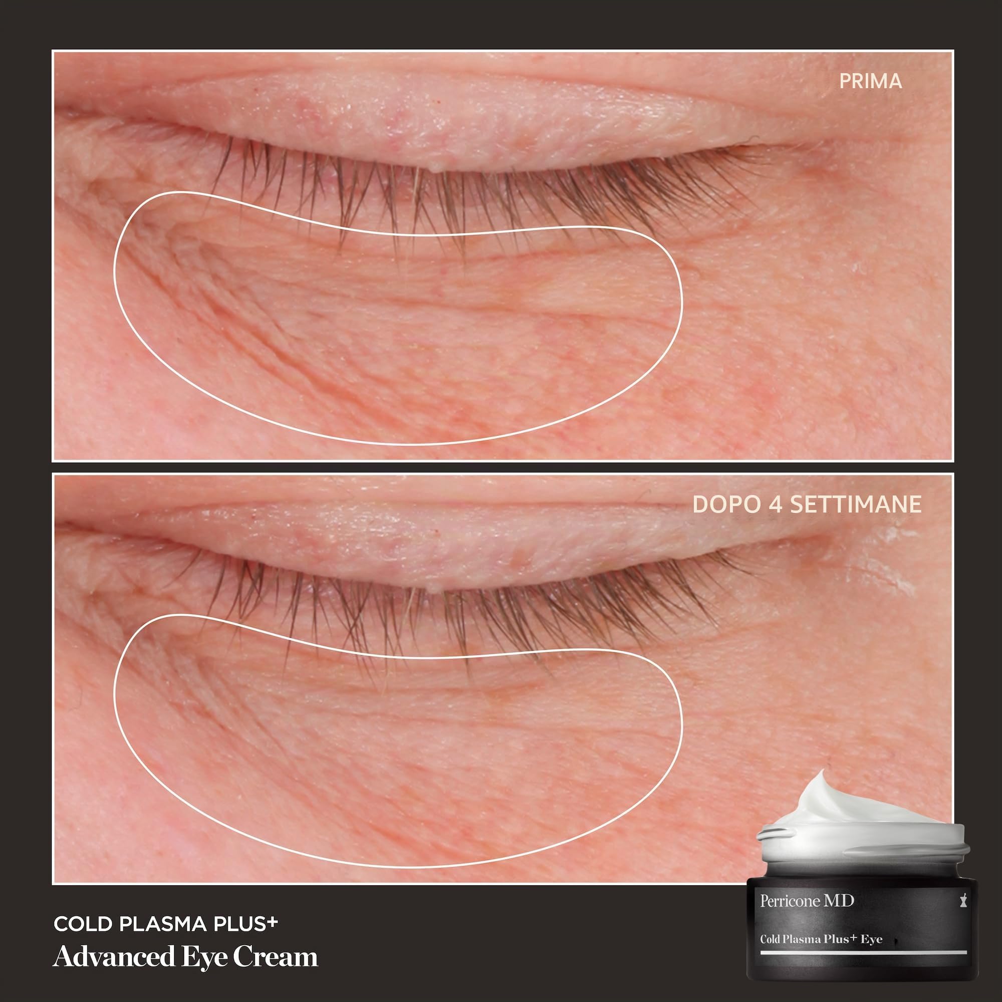 Perricone MD Advanced Cold Plasma Plus+ Eye Cream 15ml | Advanced skincare targeting visible signs of ageing, including texture, tone and firmness.