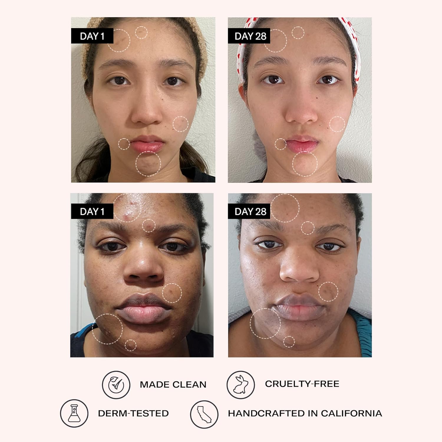 Odacite Clarifying Salicylic & Hyaluronic Acid Facial Serum for Acne - Acne-Prone Face Serum Reduces Blemishes & Clogged Pores - Vitamin E & Ylang Ylang Floral Water - 1 Fl Oz