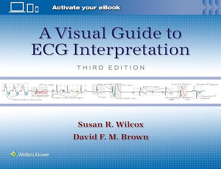 A Visual Guide to ECG Interpretation Print + eBook with Multimedia