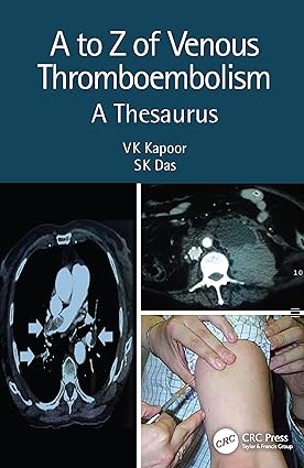 A TO Z OF VENOUS THROMBOEMBOLISM A THESAURUS 2ED (PB 2021)