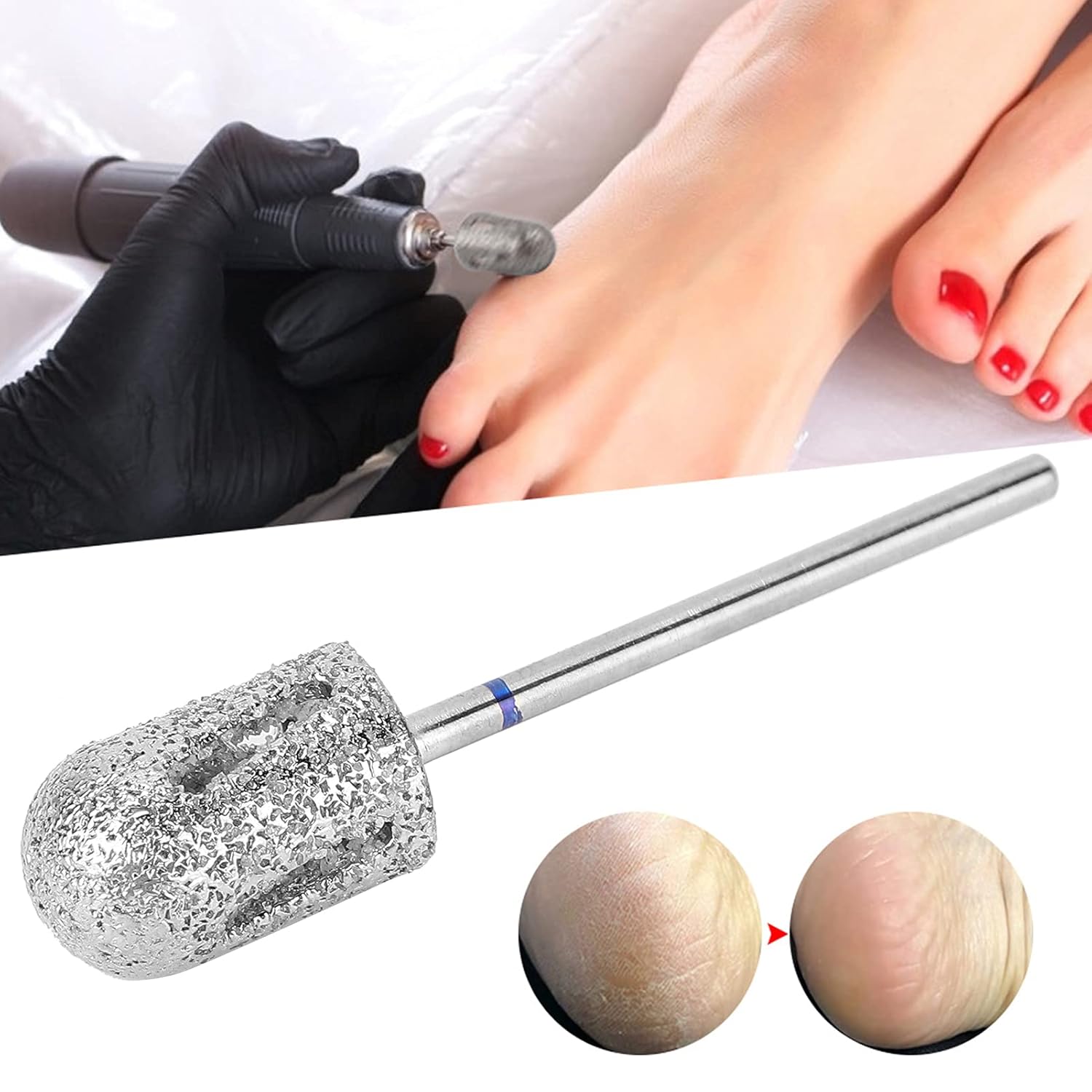 Drill Bit Safety Enough to Use,Stainless Steel Pedicure Drill Bit for Foot Calluses,Foot Nail Drill Bit Polishing Head Accessories for Repair Foot Skin(A1C)
