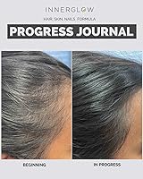 Vista 14 de Vitaminas Avanzadas para el Cabello, la Piel y las Uñas – Suplemento Capilar Desarrollado por Médicos con Biotina, Péptidos de Colágeno, Vitamina E
