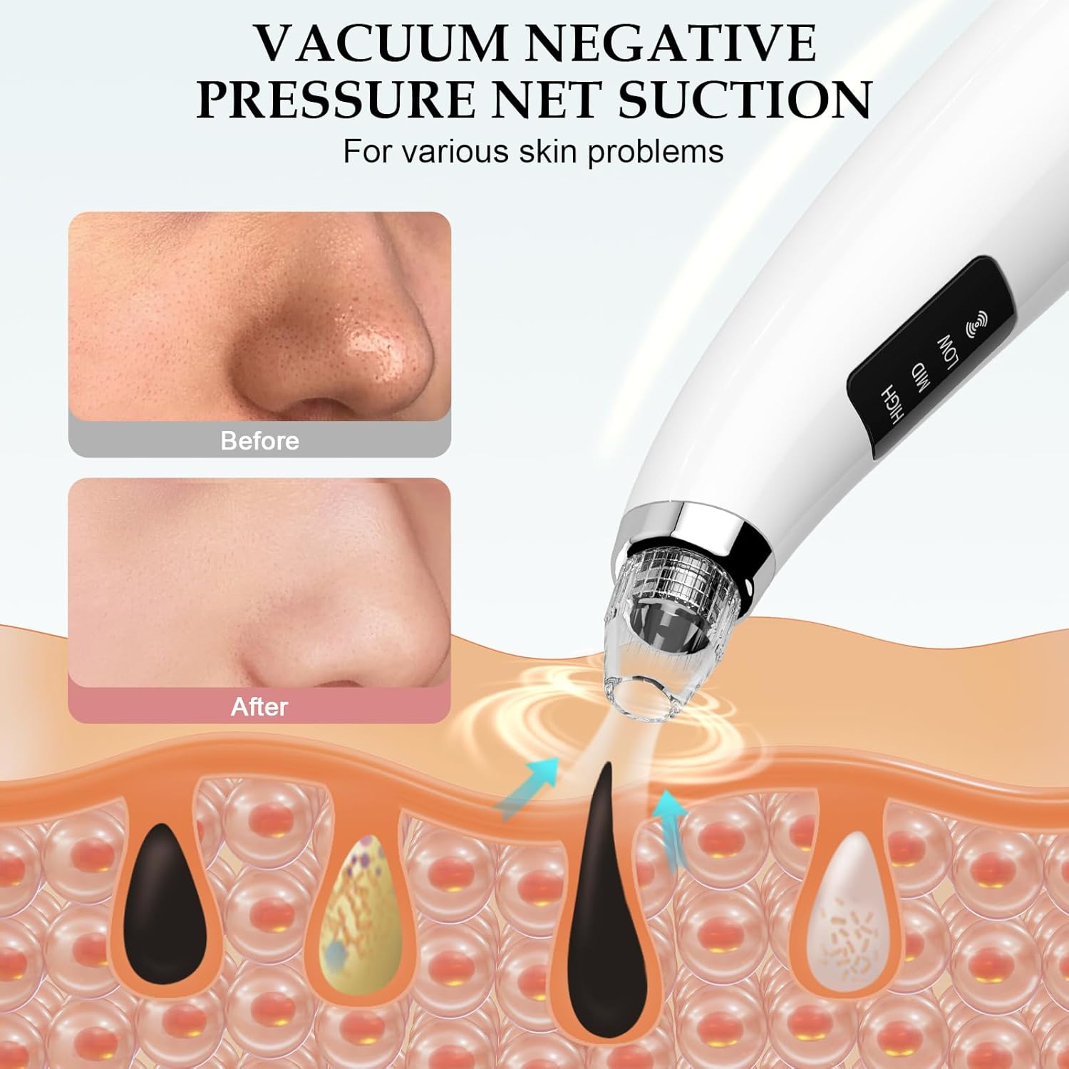 Pore Vacuum Blackhead Remover Tool - Blackhead Remover Vacuum with 3 Adjustable Suction Levels, 5 Probes - Pore Cleaner Kit for Women&Men (Pearl White) - Image 3