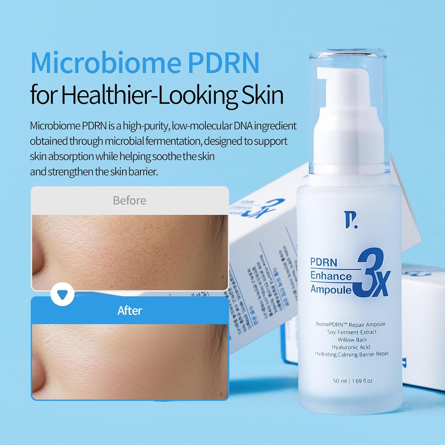 PAMS IBC 3X PDRN Enhance Ampoule, Biome-PDRN Hydrating Repair Serum for Sensitive Barrier-Damaged Skin, Developed with Korean Professional Estheticians, 1.69 fl.oz.