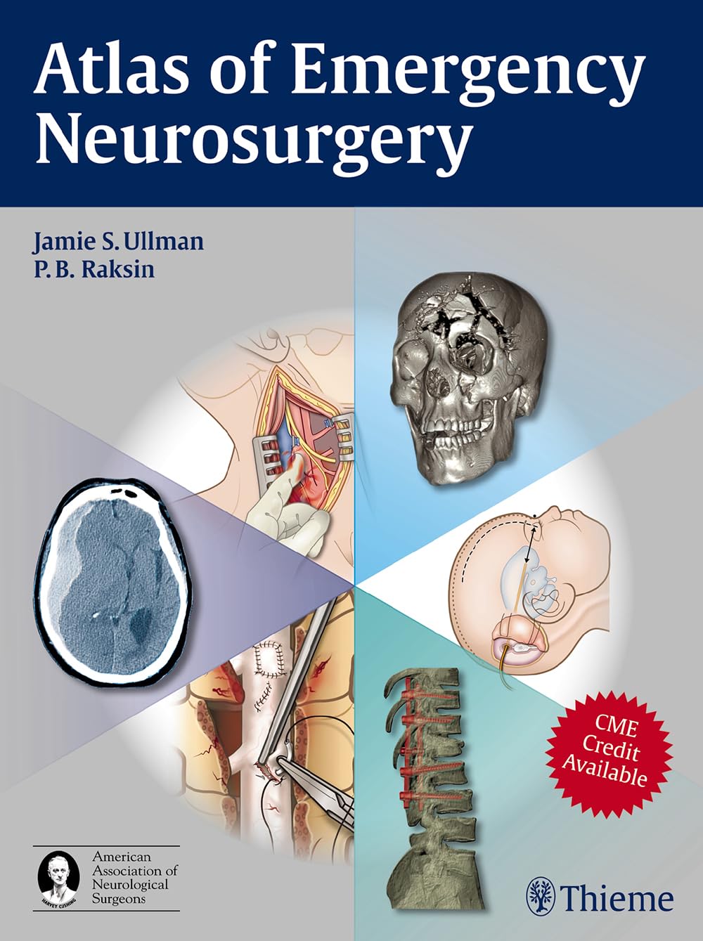 Atlas of Emergency Neurosurgery Ullman Raksin Hardback MM – Thieme 9781604063684