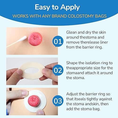 Miniatura 7 de 30 anillos de barrera para ostomía, anillos moldeables de ostomía de 0.157 in de grosor, anillos de barrera adhesiva hidrocoloide de grado médico,