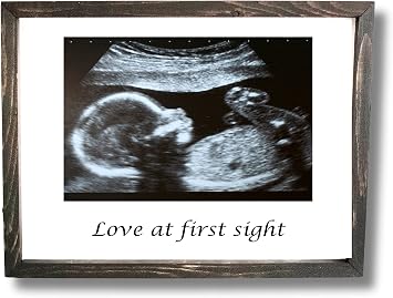 Schafer Art Studio Ultrasound Baby Photo Print on Canvas, Love at First Sight, Heartbeat Keepsake, Sonogram Picture Canvas Print, Customized ultrasound photo gift