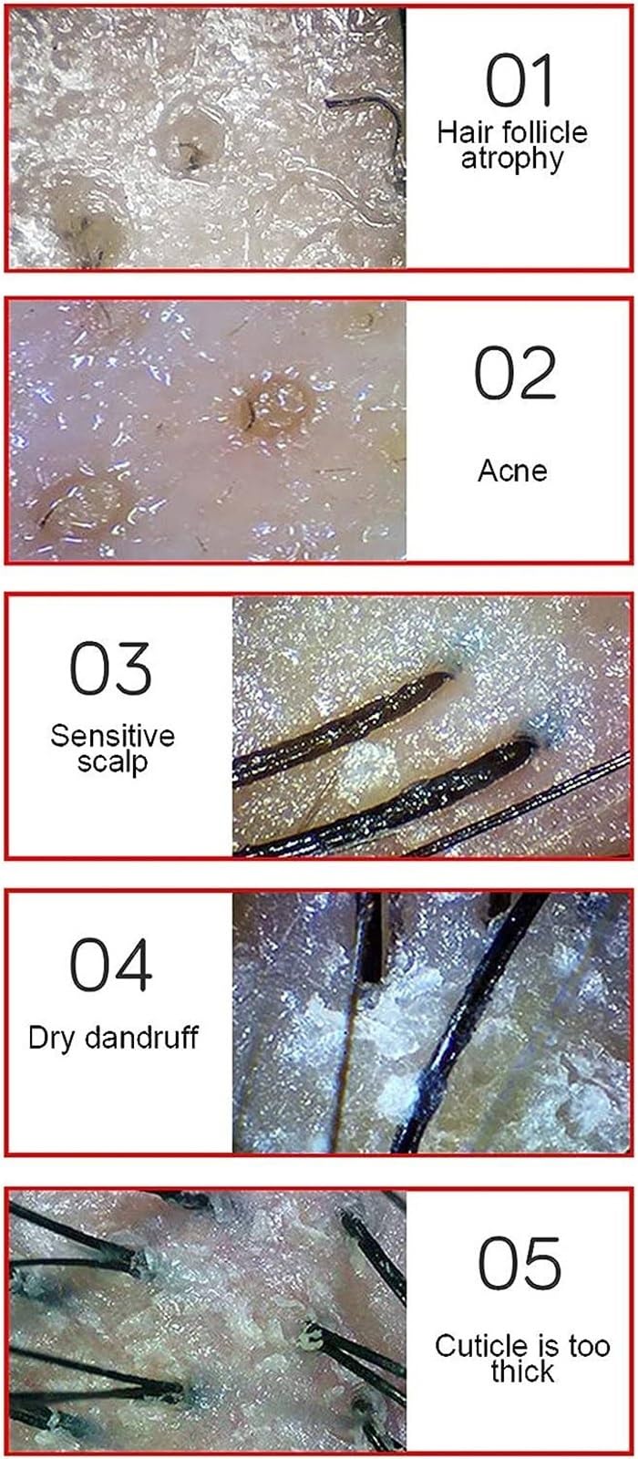 Détecteur de peau et de cuir chevelu, 13 pouces, analyseur de peau numérique, testeur d'humidité, analyseur de peau et de follicules pileux rechargeable