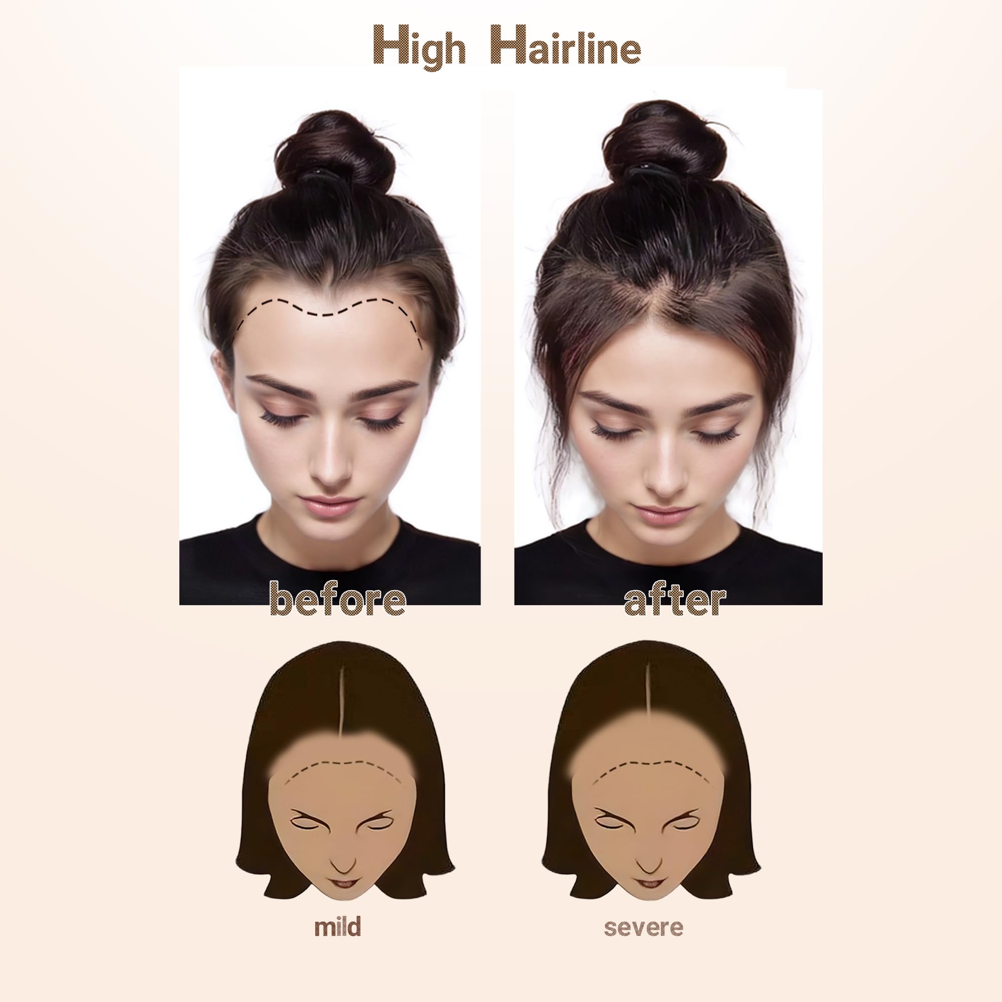 Human Hair Topper Straight Tape On V Shape Hairline Hair Extension Amazon.com : viviaBella men main image 4