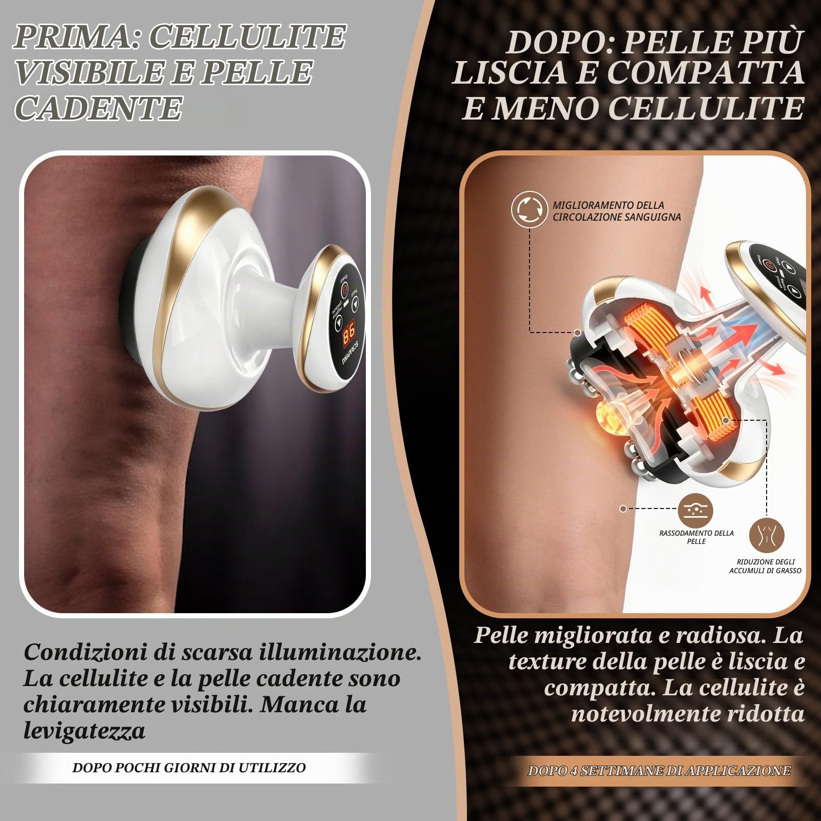 Cellulite Massaggiatore, Massaggiatore elettrico 4 in 1 con terapia del calore, coppettatrice sottovuoto & Gua Sha, 9 livelli di riscaldamento e funzione di aspirazione, per pancia gambe