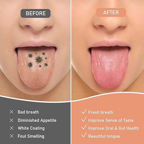 Miniatura 2 de Paquete de 8 raspadores de lengua de acero inoxidable, plata y oro rosa