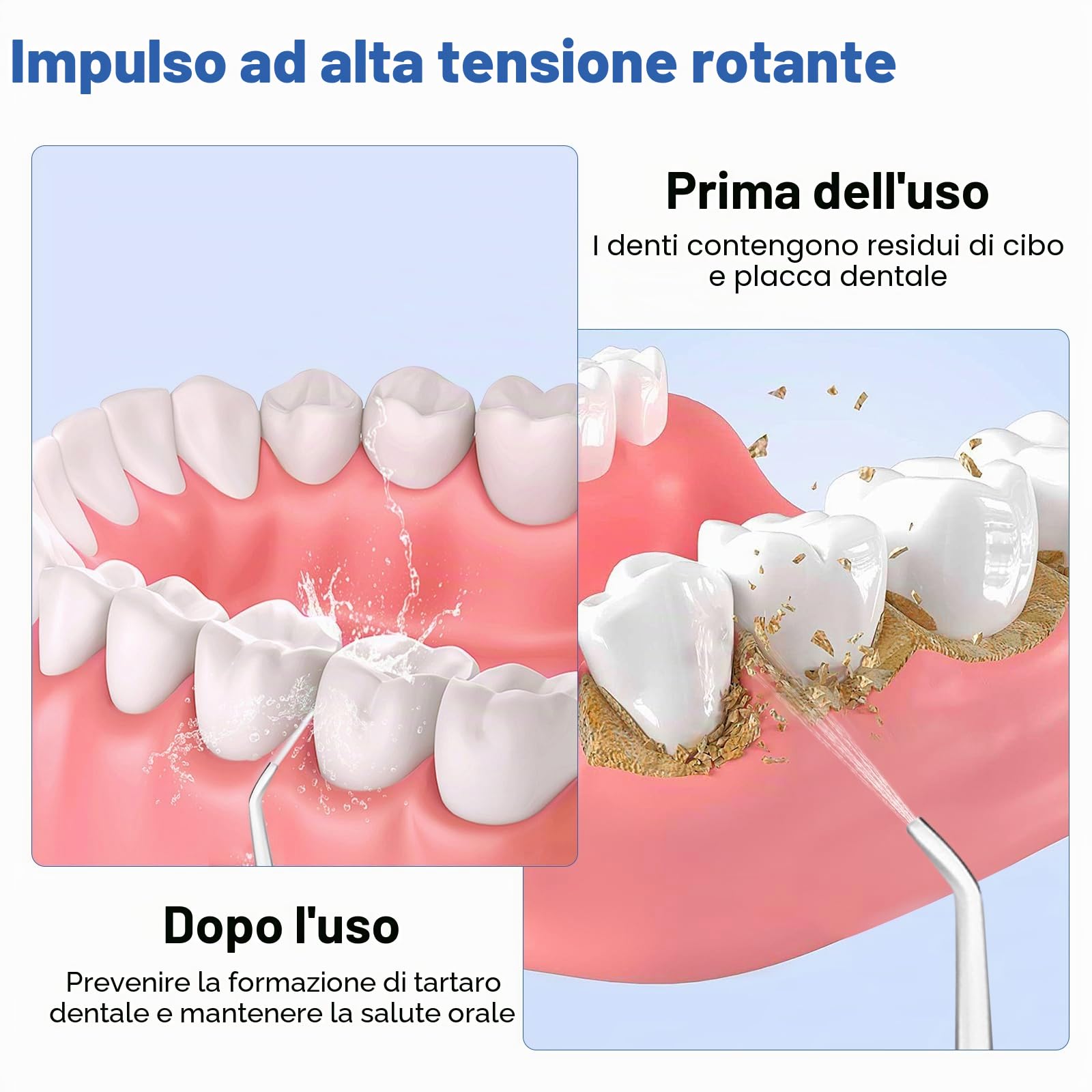 Idropulsore Dentale Oral,Irrigatore Orale,Idropulsore Dentale Portatile,Elettrico Oral Water,con 5 Modalità e 6 Beccucci,Serbatoio da 380ml,Impermeabile IPX7,per Uso Domestico e Viaggi(Bianco)