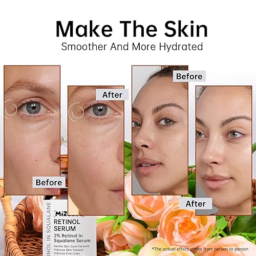 Miniatura 7 de Retinol 2% en suero de escualano para cara, 1.0 fl oz suero de retinol antienvejecimiento para líneas finas y acné, piel seca, hidratante.