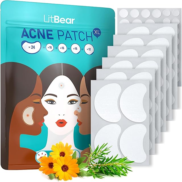 LitBear Acne Patches Large, Hydrocolloid Pimple Patches for Large Breakouts, Zit and Blemish, Large Acne Patches for Face, Chin, Back and Body with Tea Tree Oil, 5 Size 84 Patches
