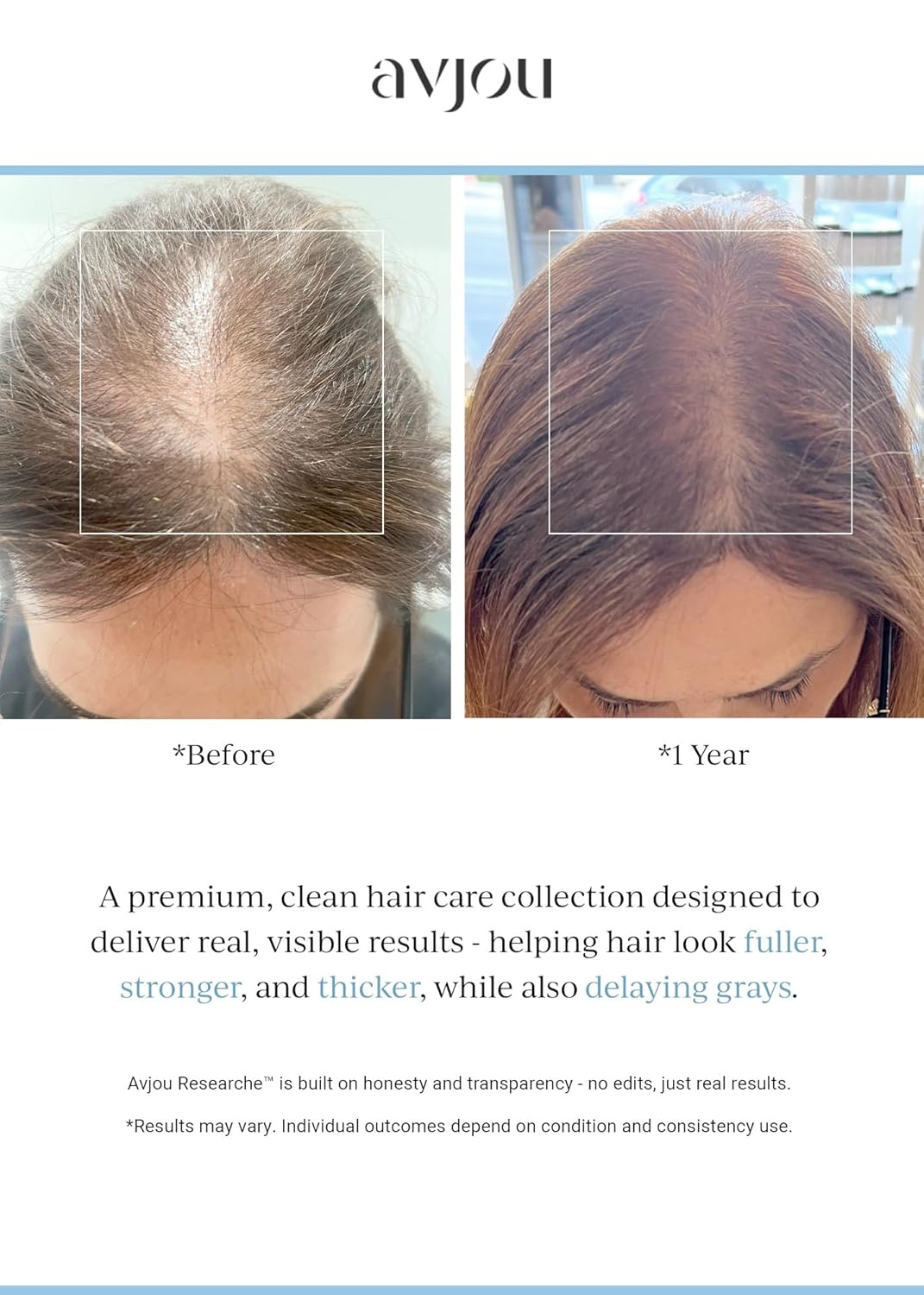 Avjou Researche™ Scalp Serum – Thicker, Fuller-Looking Hair + Targets Visible Signs of Premature Greying – 3 Patented Ingredients – Backed by Cosmetic Science – Oil-Free, All Hair Types, 1.7 oz - Image 6