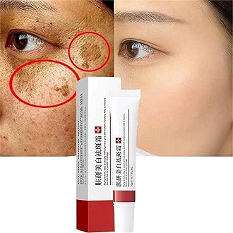 Whitening Freckle Cream,Pigmentation Removal Cream for Face,Remove Dark Spots Anti-Freckle Cream,Anti-wrinkle Moisturizing Anti-blemish Cream,Suitable for All Skin Types (2pcs)