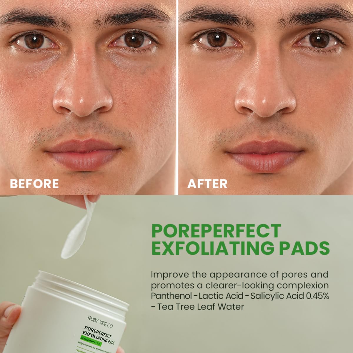 Pore Refining Toner Pads – Exfoliating Pads with Salicylic Acid 0.45%, Lactic Acid & Tea Tree, Dual-Textured Facial Pad for Oil Control & Smoother Skin - 60 Pads