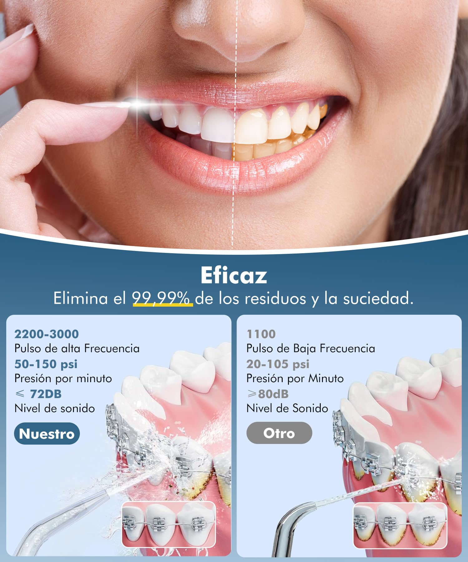 Irrigador Dental Portatil Profesional Inalámbrico 5 Boquillas 4 Modos IPX7 USB-C Recargable