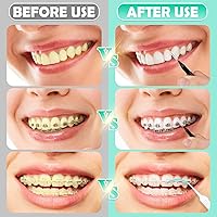 Vista 4 de Juego de cepillos interdentales de 320 piezas, púas de hilo dental suaves y flexibles para aparatos ortopédicos, cuidado de ortodoncia, limpieza