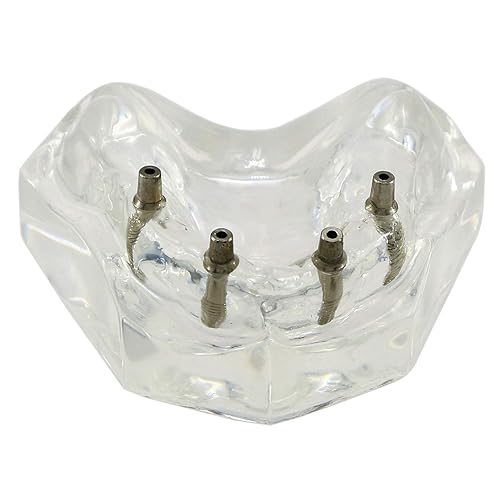 Miniatura 8 de Modelo de sobredentadura dental con 4 dientes superiores Demo Visión transparente para educación y estudio modelo herramienta M6001 C