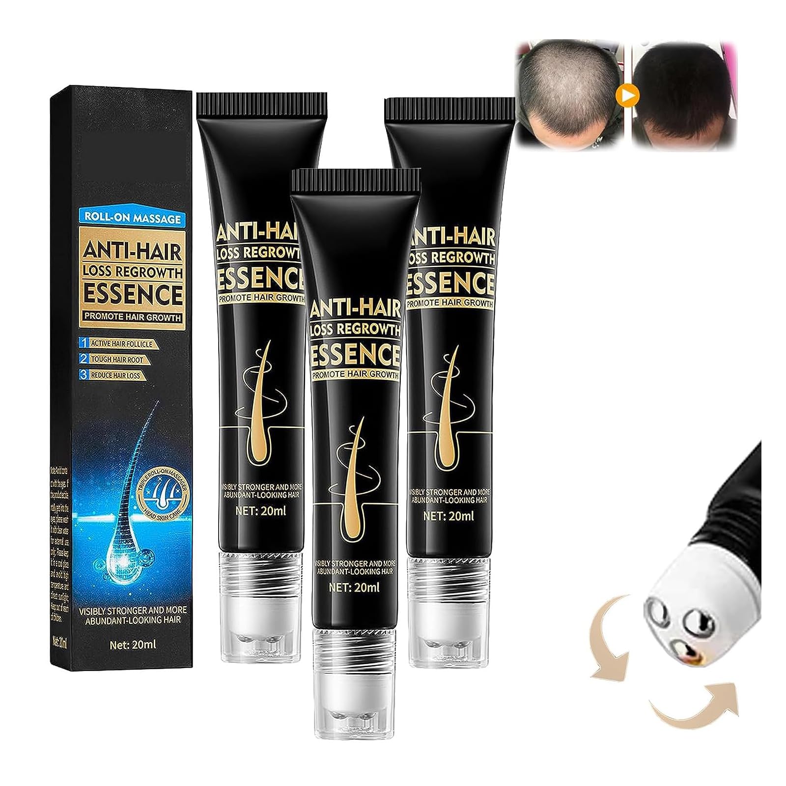 Stovis Biotin Hair Growth Roll-On Massage Essence, Stovis Biotin Hair Growth Essential Oil, Stovis Keratin Hair Serum for Hair Growth, Frizzy and Damaged Hair, Men and Women (3PC)