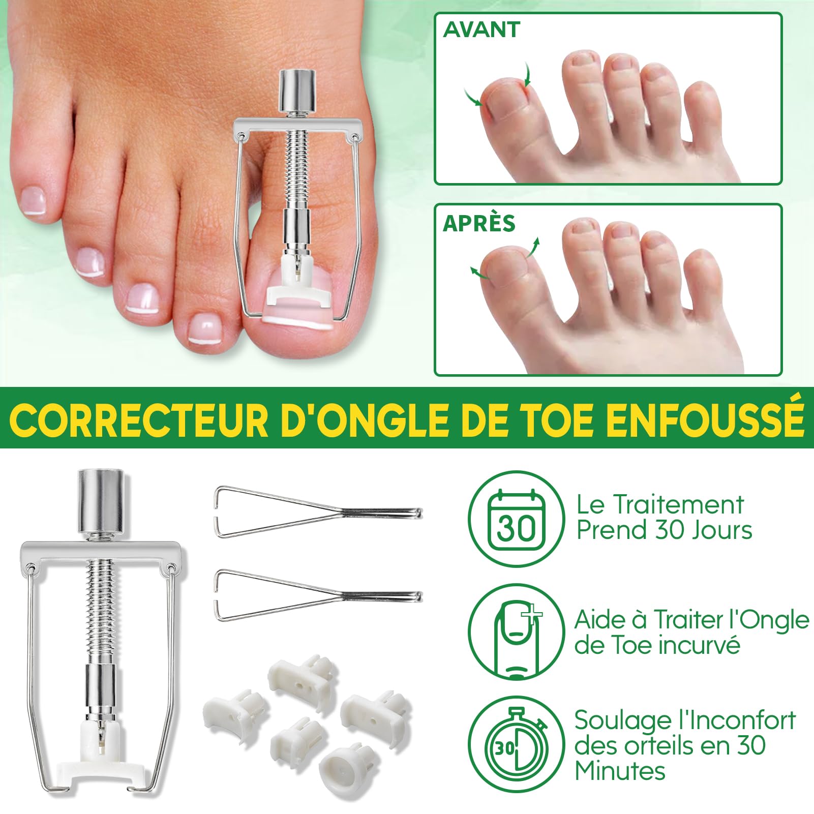 XIFEPFR Kit d'Outils pour Ongle Incarné, Traitement pour Ongle Incarné, Kit de Retrait d'Ongles Incarnés, Correcteur d'Ongle Incarné, Patch Correcteur, Coupe Ongle, Pince Cuticule et Outil de Pédicure