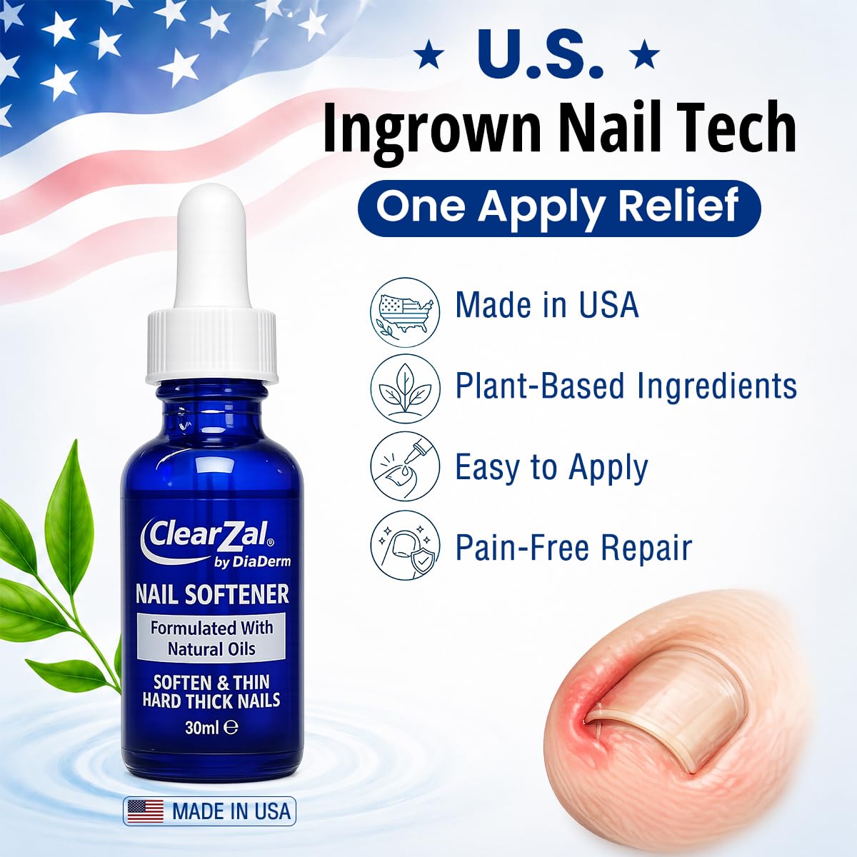 ClearZal Ingrown Nail Fix Ingrown Toenail Relief & Softening Solution, Extra Strength for Thick Hard Nails, Professional Nail Care Fix, 1 fl oz / 30ml