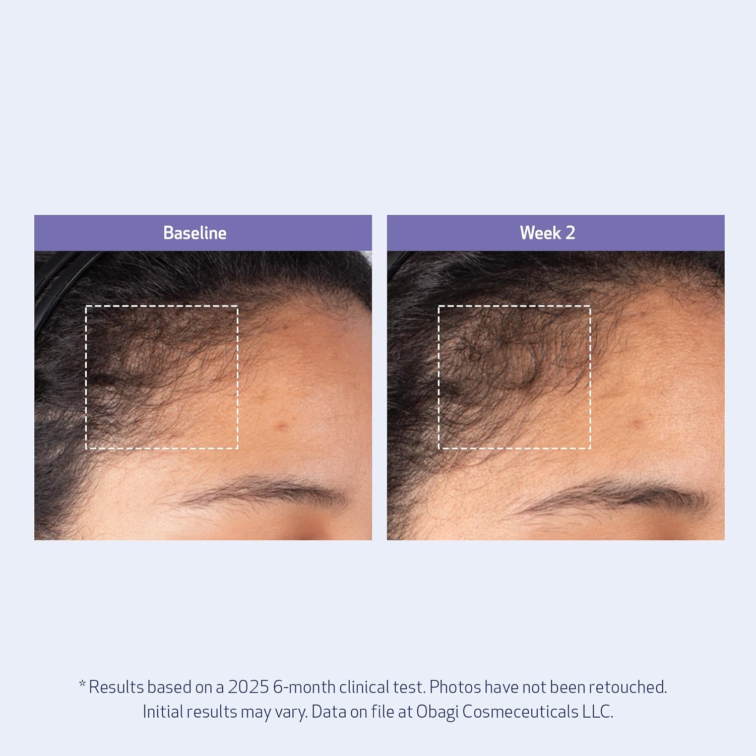 Obagi Nu-Cil BioStim Hair Scalp Serum with Biotin – Clinically Proven to Promote Scalp Health & Deliver Visibly Fuller, Denser Hair – Lightweight, Strengthens Follicles, & Encourages Regrowth – 2 oz - Image 7