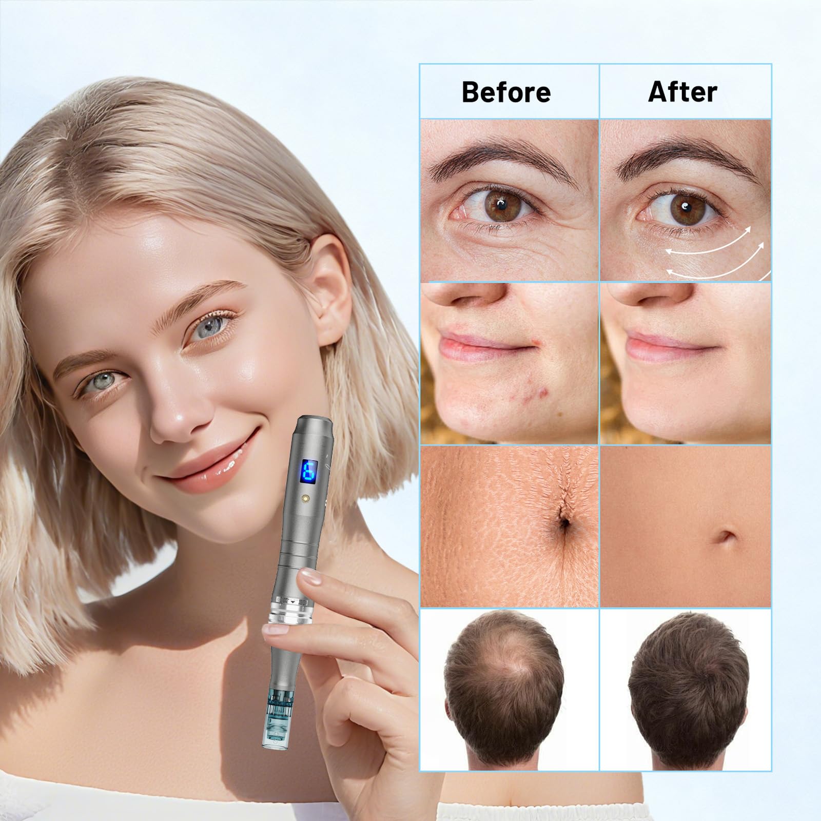 Dr. Pen M8S Microneedling Pen Professionale Wireless, Dermapen Elettrico Senza Fili con 25 Cartucce Aghi Originali, 6 Velocità Regolabili e Display LED, Trattamento Pelle Viso, Capelli e Corpo