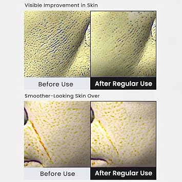 Retinal Shot Tightening Booster Krem, Sıkılaştırıcı Yüz Kremi, Gece Kremi Yenileyici 30 ml