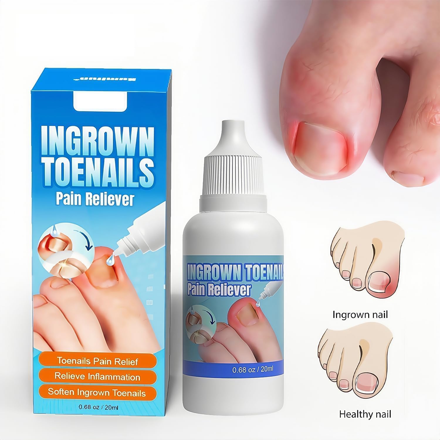 Ingrown Toenail Treatments, Ingrown Nail Treatment for Toenails Extra-Strong, Ingrowning Toenail Treatment, 20ml - Image 2