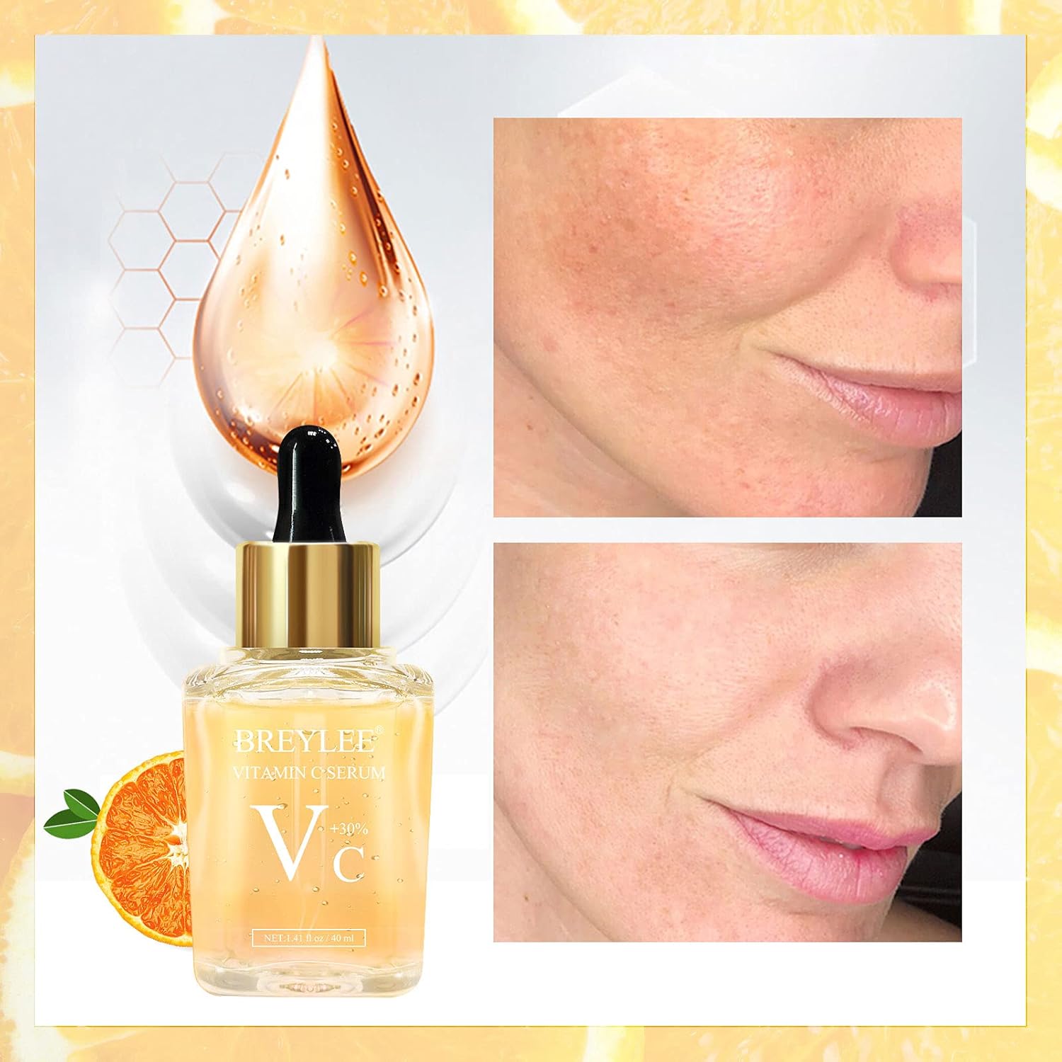 Vitamin C Serum for Face, BREYLEE Moisturizing Serum Face Serum with 30% Vitamin C, Hydrating Serum for Skin Care, Vitamin C Facial Serum with Hyaluronic Acid & Vitamin E, 1.41fl oz : Beauty & Personal Care