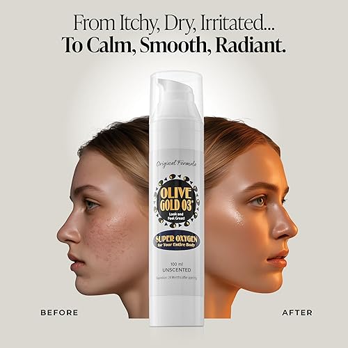 Miniatura 3 de Olive Gold O3 Loción para el cuidado de la piel - Aceite de oliva ozonizado súper oxígeno (4 onzas)