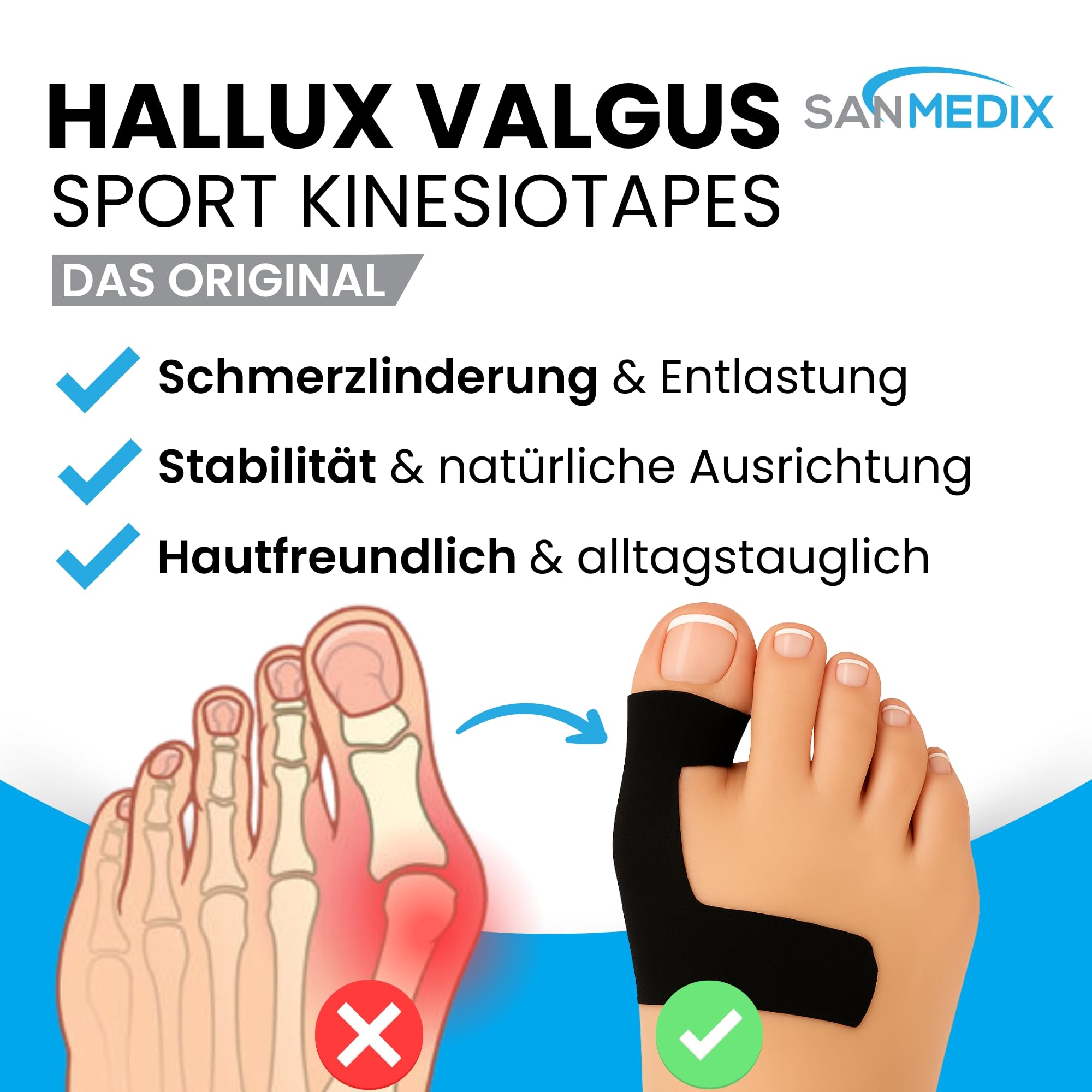 Hallux Valgus Kinesiotape – 20 bandes prédécoupées Sport & Physio Tapes pour orteil et pied – Bande de kinésiologie prédécoupée pour hallux valgus, respectueuse de la peau et sans latex (Noir