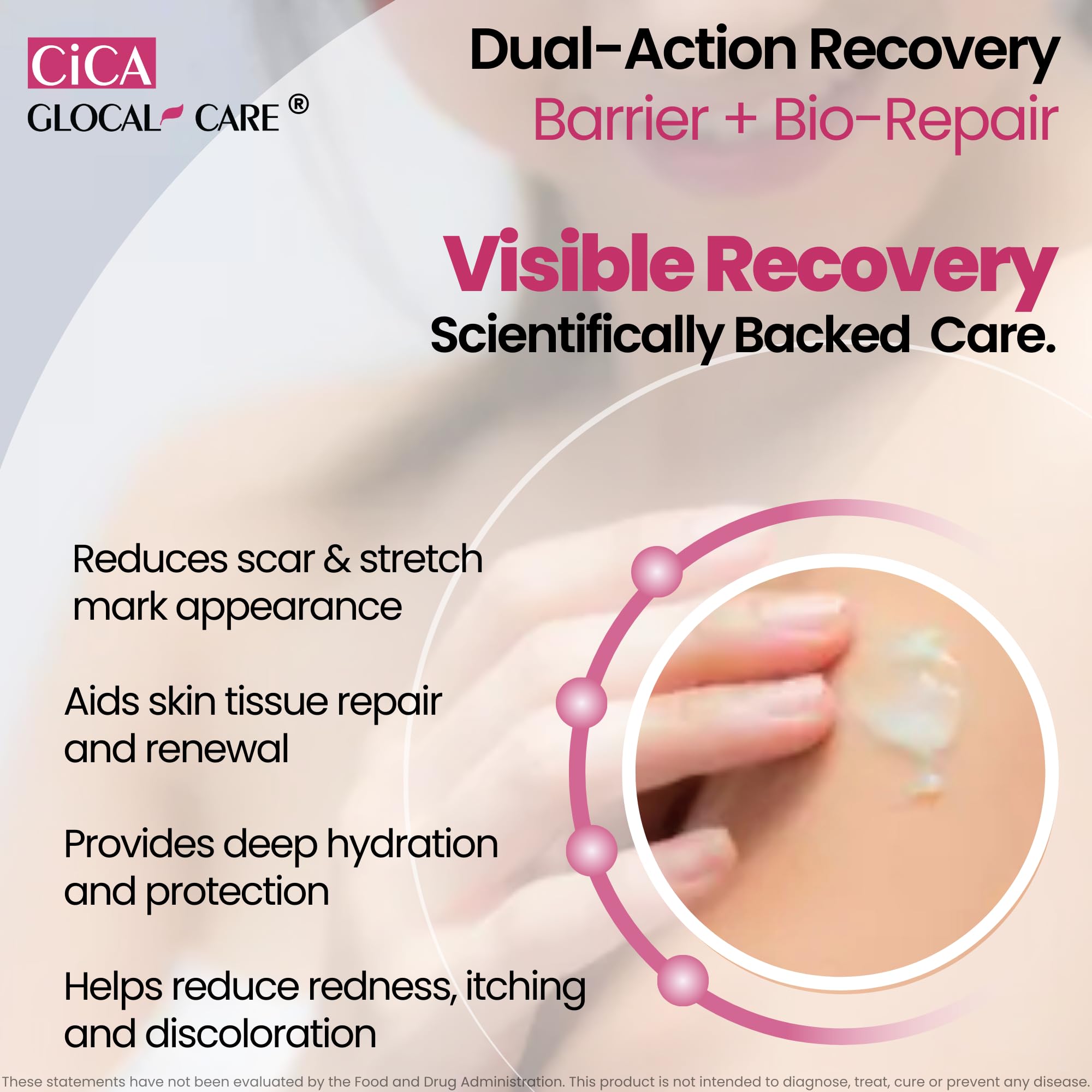 CICA Silicone Scar Cream – Helps with Scar Removal - Surgical, Acne & Trauma Scars, Stretch Mark Cream for New & Old Scars – Medical Grade Silicone with TECA & Hyaluronic Acid — Amazon image 2