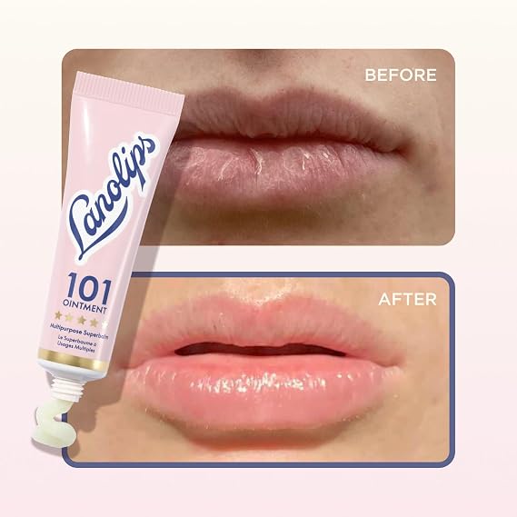 Lanolips Complete Lip Care Duo - Lanolips 101 Lanolin Lip Balm & Overnight Lip Mask Duo, Lanostick (0.116 oz), Daily & Overnight Hydration Set