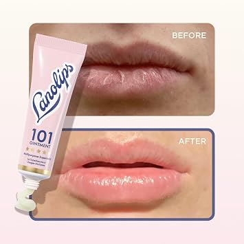 Lanolips Complete Lip Care Duo - Lanolips 101 Lanolin Lip Balm & Overnight Lip Mask Duo, Lanostick (0.116 oz), Daily & Overnight Hydration Set