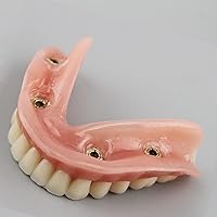 Vista 4 de Demostración de implantes inferiores de 4 implantes para enseñar y estudiar