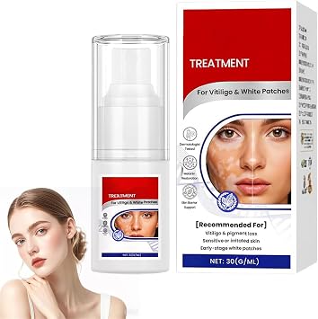 Vitiligo Spray, Vitiligo Treatment Spray, Professional Skin White Spot Remover,Reduce White Spots and Improve Skin Pigmentation,Suitable for All Skin Types 1Pcs
