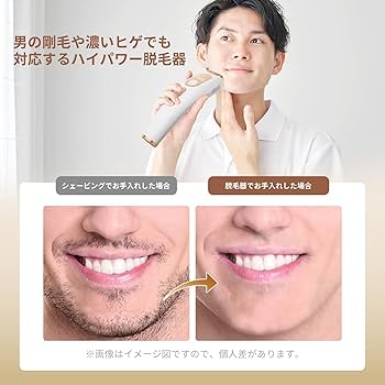 Amazon | YUNDOO脱毛器 メンズ レディース VIO対応 IPL技術 9