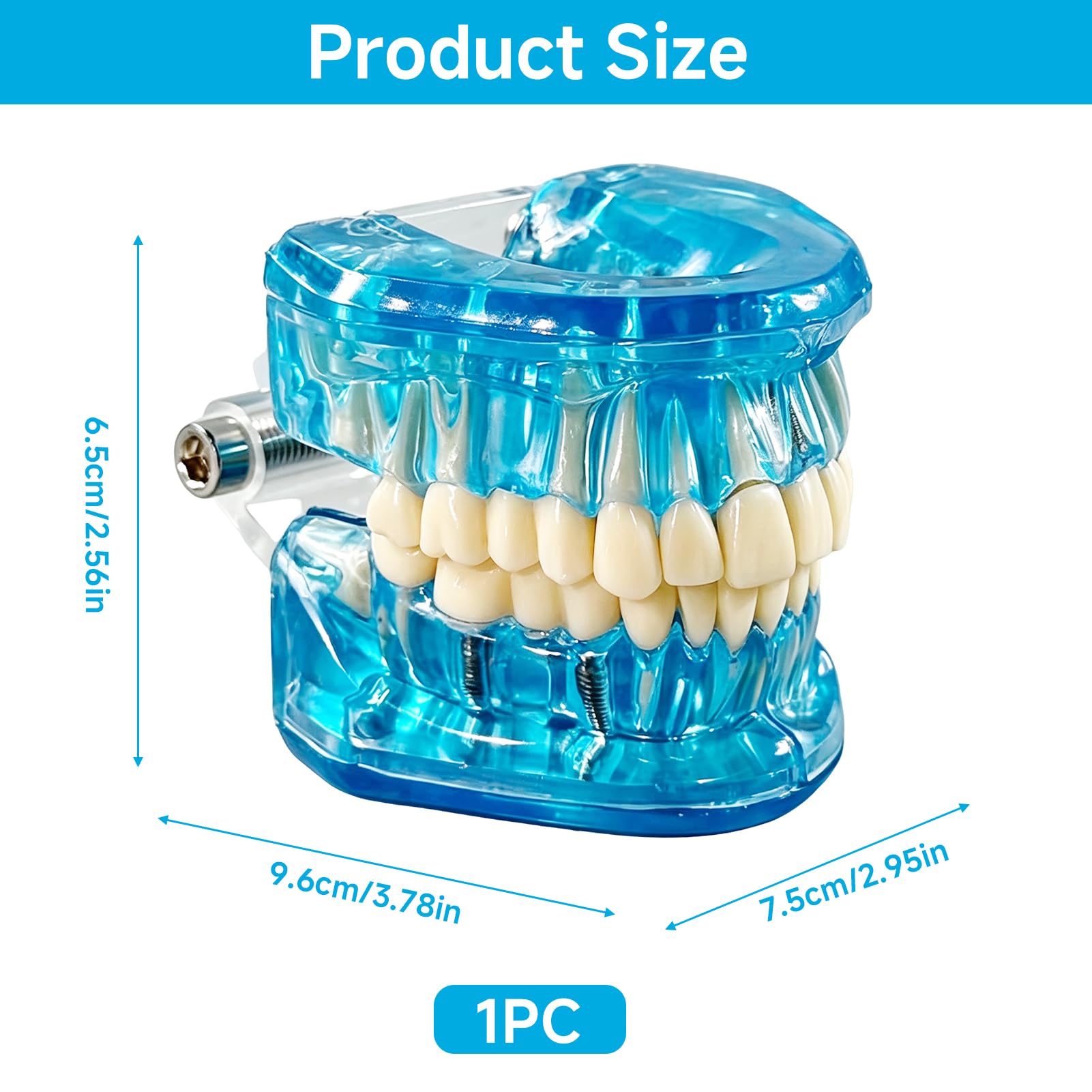 Zahnmodell mit Herausnehmbaren ZäHnen, Zahnimplantat Zahnmodell,Transparentes Modell Erkrankter ZäHne, modell für Zahnarzt, Dental Model für Demonstrationen und Studien(Blau)
