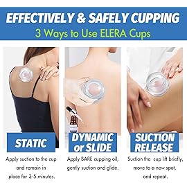 ELERA Silicone Cupping Therapy L Size Sets, Professionally Chinese Massage Cups Tools, Silicone Cup for Joint Pain Relief, Massage Body (L*2 Cups)
