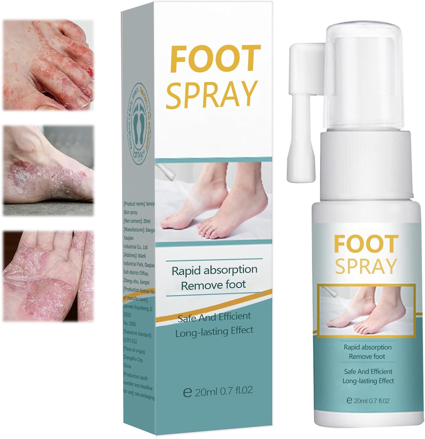 Athletes Foot Spray, Athletes Foot Treatmênt, Effective Athletes Foot