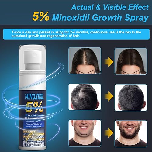 Miniatura 3 de 5% de minoxidil para hombres y mujeres, suero de biotina para el crecimiento del cabello con batana y romero para tratamientos de crecimiento de