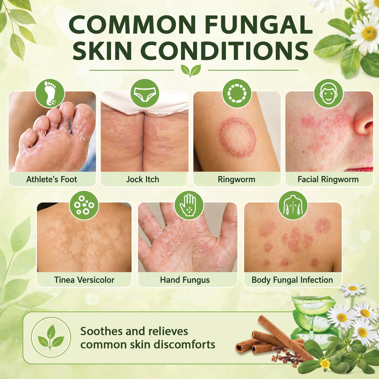 Crème Antifongique mycose pied Traitement : Crème de Soin pour les Peaux Sujettes aux Démangeaisons, au Pied d’Athlète, aux Inconforts de l’Aine, au Pityriasis Versicolor et à la Teigne, Sans Stéroïde
