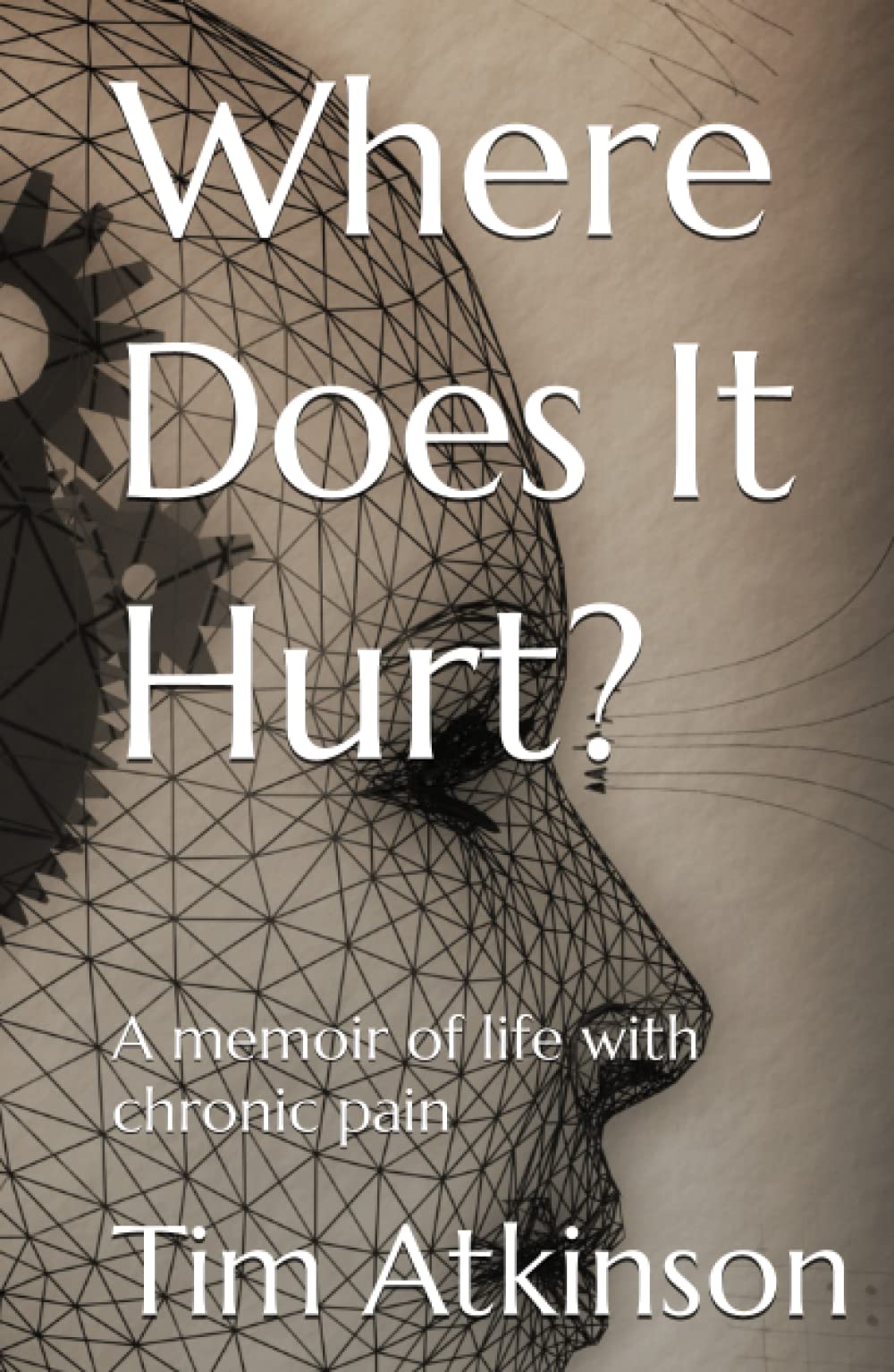 Where Does It Hurt?: A memoir of life with chronic pain