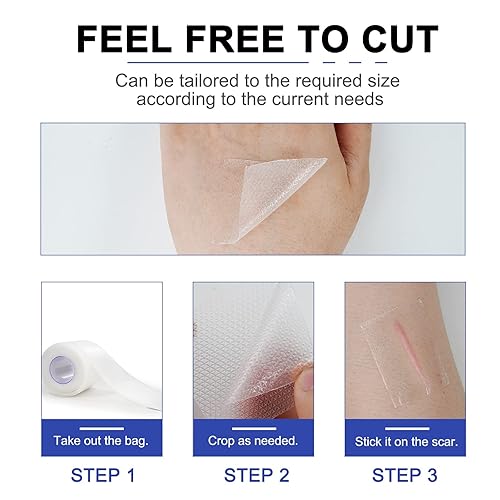 Miniatura 9 de Hojas de silicona para cicatrices (1.6 x 120 pulgadas - 3 M), cinta de cicatrices, tiras de cicatrices, reutilizables, hojas profesionales para
