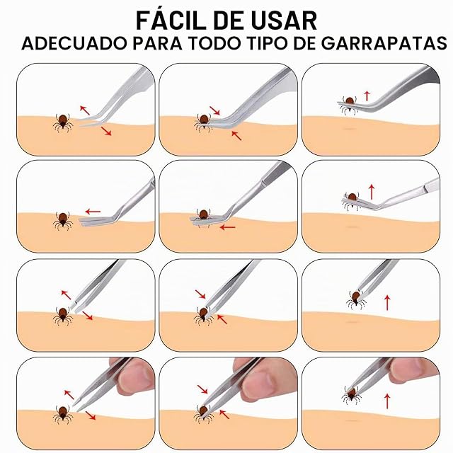 Foto 6 de 8 de EasyULT Juego 3 Pinzas para Garrapatas, Acero Inoxidable Pet Perros Gatos Garrapatas Remover Kit