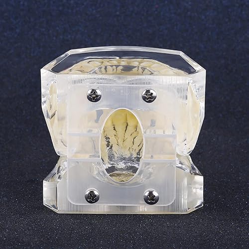 Miniatura 4 de Demostración Ortodoncia Oral Care Kits Modelo Dientes Enseñar Herramientas de Estudio con Soporte de Metal para Enseñar Herramientas de Estudio