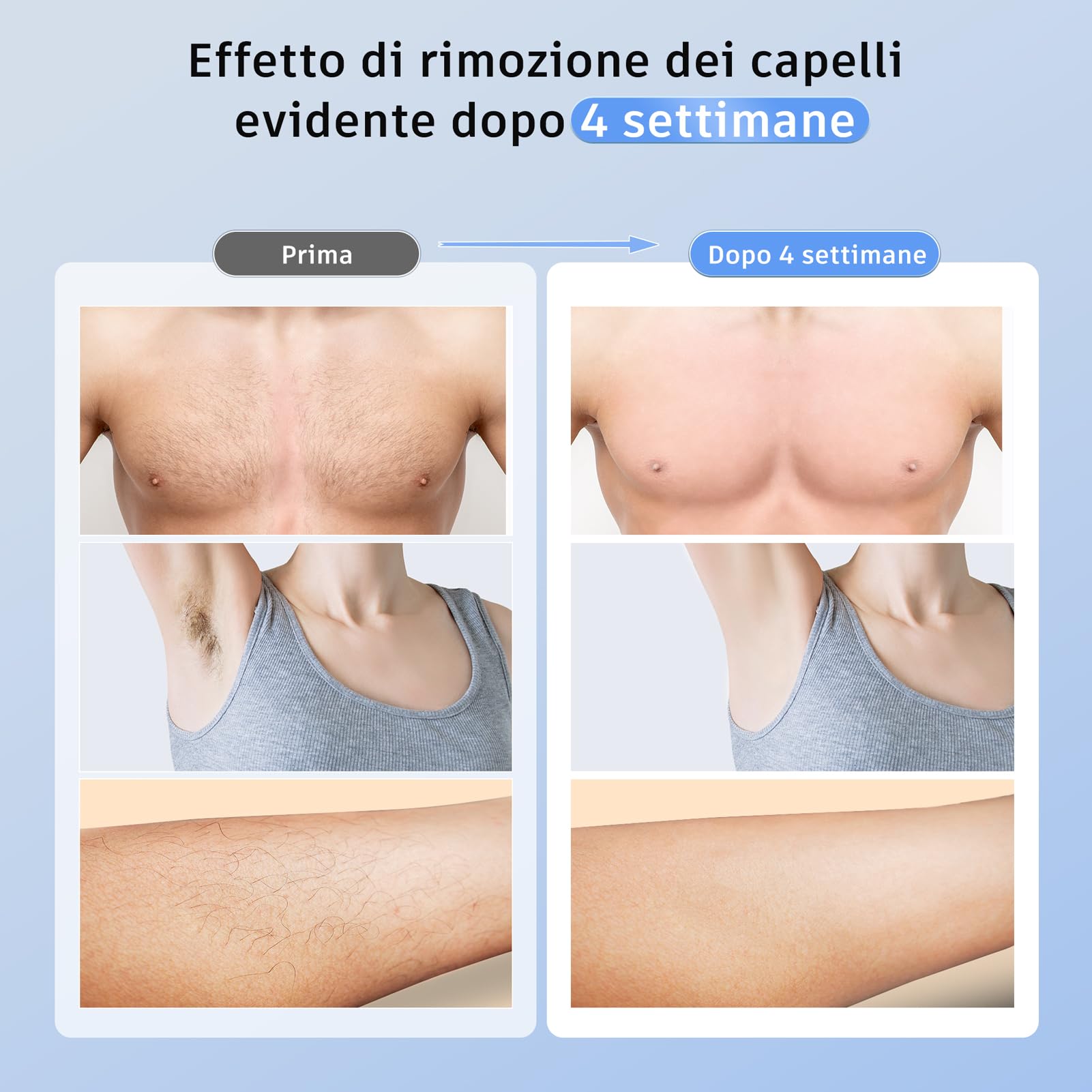 Prettivo Epilatore Luce Pulsata, Funzione di Ghiaccio, 3 in 1 HR/SC/RA, 9 Livelli di Energia(Max 19,8J), 600NM Onda Rossa, 999,900 Flash,Luce Pulsata Epilatore Laser per Donne, Uomo, Ascelle, Corpo